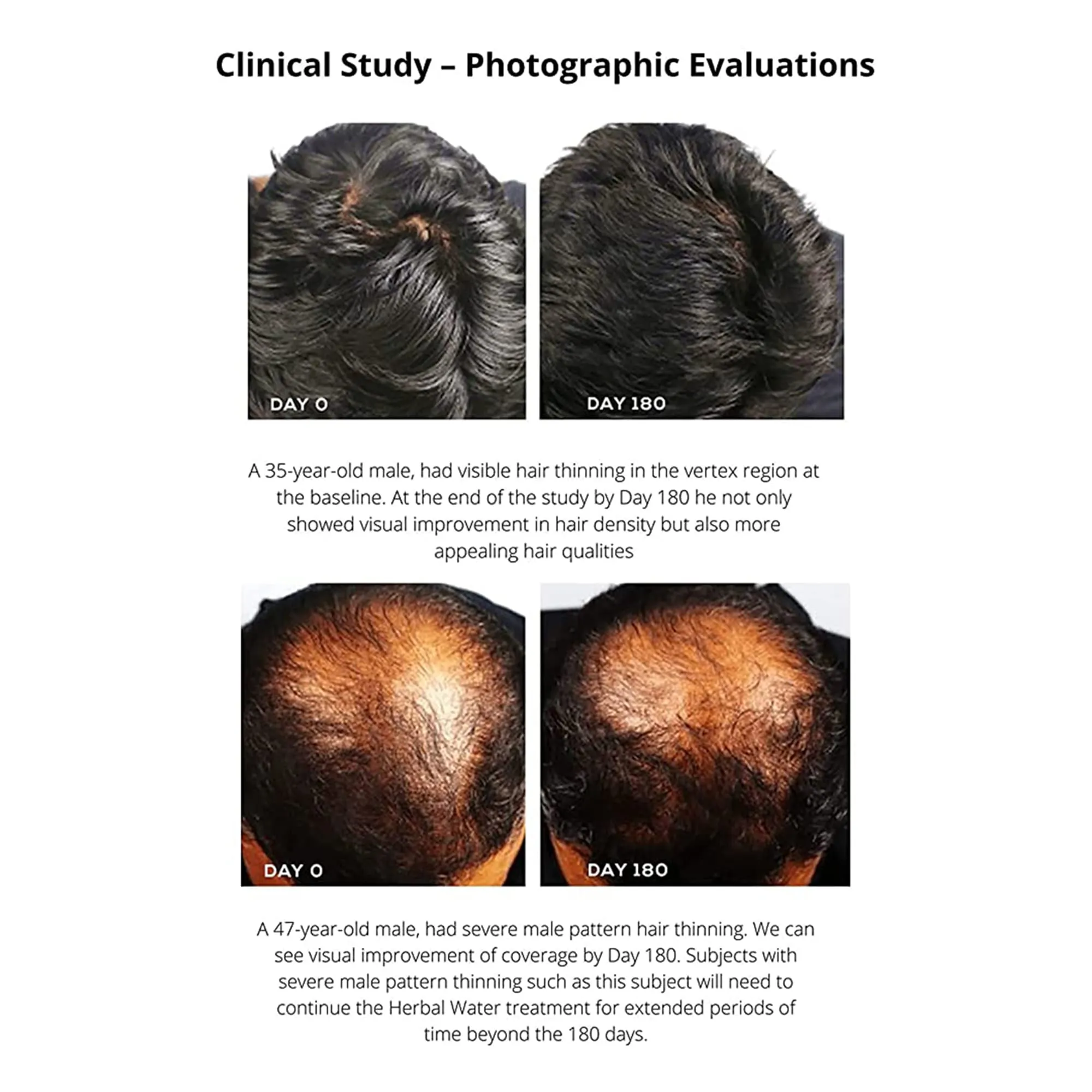 Diabliss Herbal Water For Healthy Hair 500 ml 3.webp